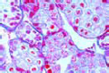 Astacus, testis t.s. with spermatogenesis