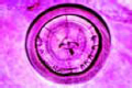 Statocyst of prawn, organ of equilibration