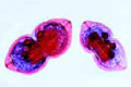 Mussel embryology. Glochidia larva slide