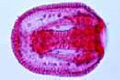 Sea-urchin embryology, Progressive gastrulation