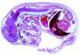 Pig embryo slide, 15 mm, near median l.s.