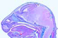 Pig embryo slide, 20 – 25 mm, head t.s.