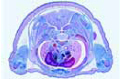 Pig embryo slide, 20 – 25 mm, thorax t.s.