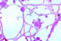 Myxoflagellatae slide, myxamoebae