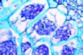 Plasmodiophora brassicae slide, clubroot slide