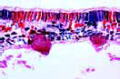 Plasmopara viticola slide, downy mildew of grapes