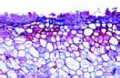 Taphrina pruni slide (Exoascus pruni slide)