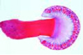 Claviceps purpurea slide, stroma with perithecia