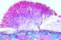 Sclerotinia fructigena (Monilia albicans slide), plum rot slide