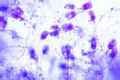 Penicillium slide, blue mold slide