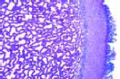 Scleroderma vulgare slide