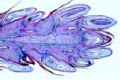 Pinus, stem apex shows meristematic tissue