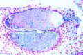 Pinus, young proembryo median