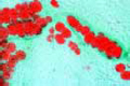 Adipose tissue slide, human
