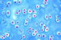 Hyaline cartilage slide, human