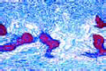 Bone development slide (intracartilaginous)
