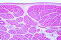 Striated (skeletal) muscle slide, human