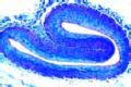 Vein, human slide, t.s. routine stained