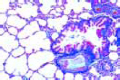 Lung, human slide, sec. routine stained