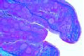 Tonsil slide (Tonsilla palatina), human