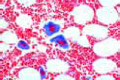 Red bone marrow slide, human rib
