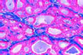 Thyroid gland slide (Gl. thyreoidea slide)
