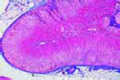Adrenal gland slide (Gl. suprarenalis slide)