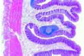Colon slide, human