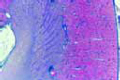 Kidney, human