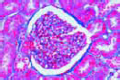 Renal papilla slide, human