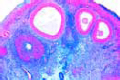 Ovary slide, mature (active phase)