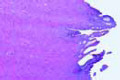 Uterus slide, human, pregnant (gravid)