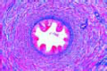 Spermatic cord  slide(Ductus deferens slide) of human
