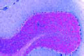 Cerebellum slide, human