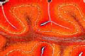 Cerebellum from human foetus