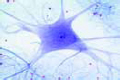Spinal cord, human, t.s. for general structure