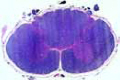 Spinal cord slide, human, t.s. cervical region