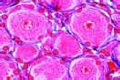 Sympathetic ganglion slide, human