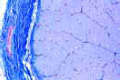 Optic nerve slide, human