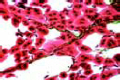 Trachea in insect intestine