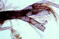 Trachea from insect