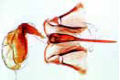 Sting and poison sac of honey bee