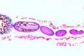 Ovary of insect showing panoistic egg tubules