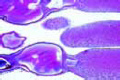 Ovary of insect showing telotrophic egg tubules
