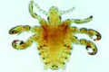 Phthirus pubis slide, human crab louse, adult