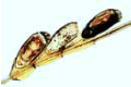 Louse eggs attached to the hair
