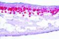 Physcia slide, sec. through thallus of a typical lichen slide