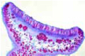 Physcia, sec. through apothecium