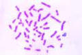 Human chromosomes slidein smear from culture of blood, male