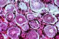 Golgi apparatus slide in sec. of spinal ganglion or other organ